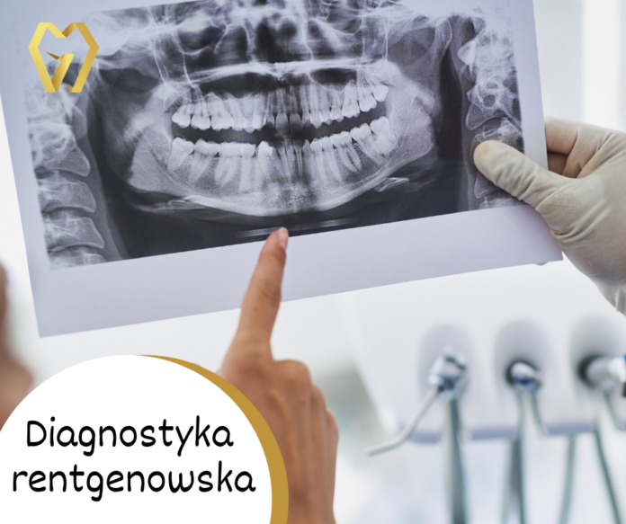 Diagnostyka rentgenowska Galeria Uśmiechu Opole
